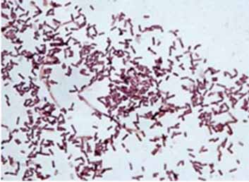 Bacillus subtilis штамм 26 Д