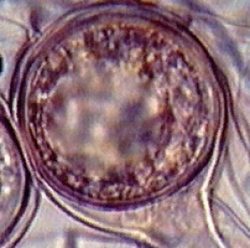 Оогоний - Оогоний <i>Phytophthora alni</i> 