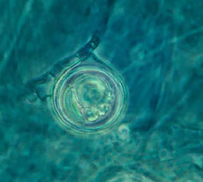 Ооспора - Ооспора <i>Pythium aphanidermatum</i> 