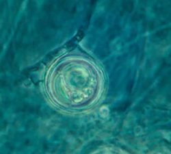 Ооспора - Ооспора <i>Pythium aphanidermatum</i> 