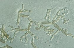 Демациевые - Цепочки конидий грибов рода <i>Cladosporium</i>